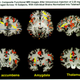 Illustration for article titled This is what your brain on drugs emreally/em looks like